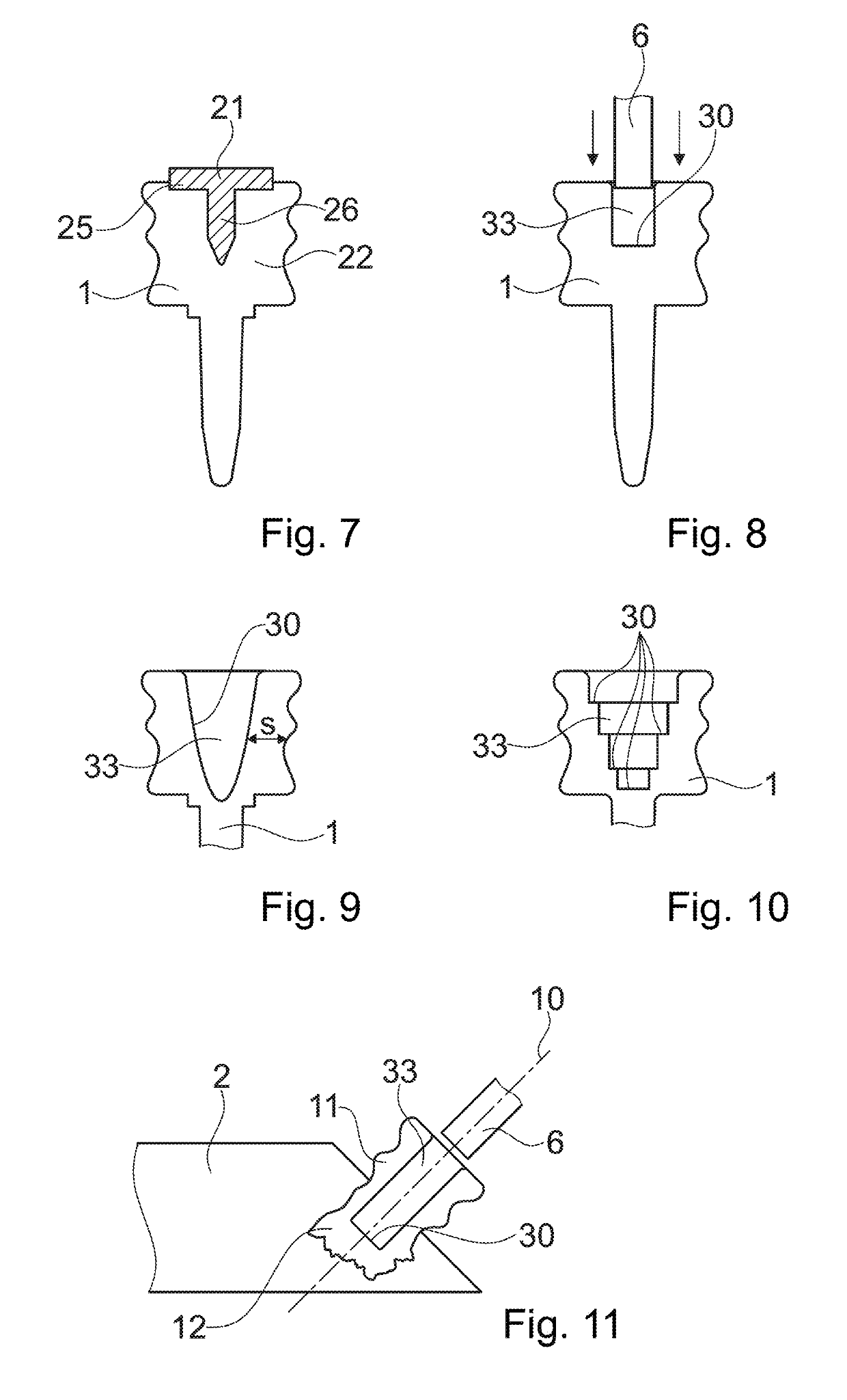 Anchoring a joining element in an object