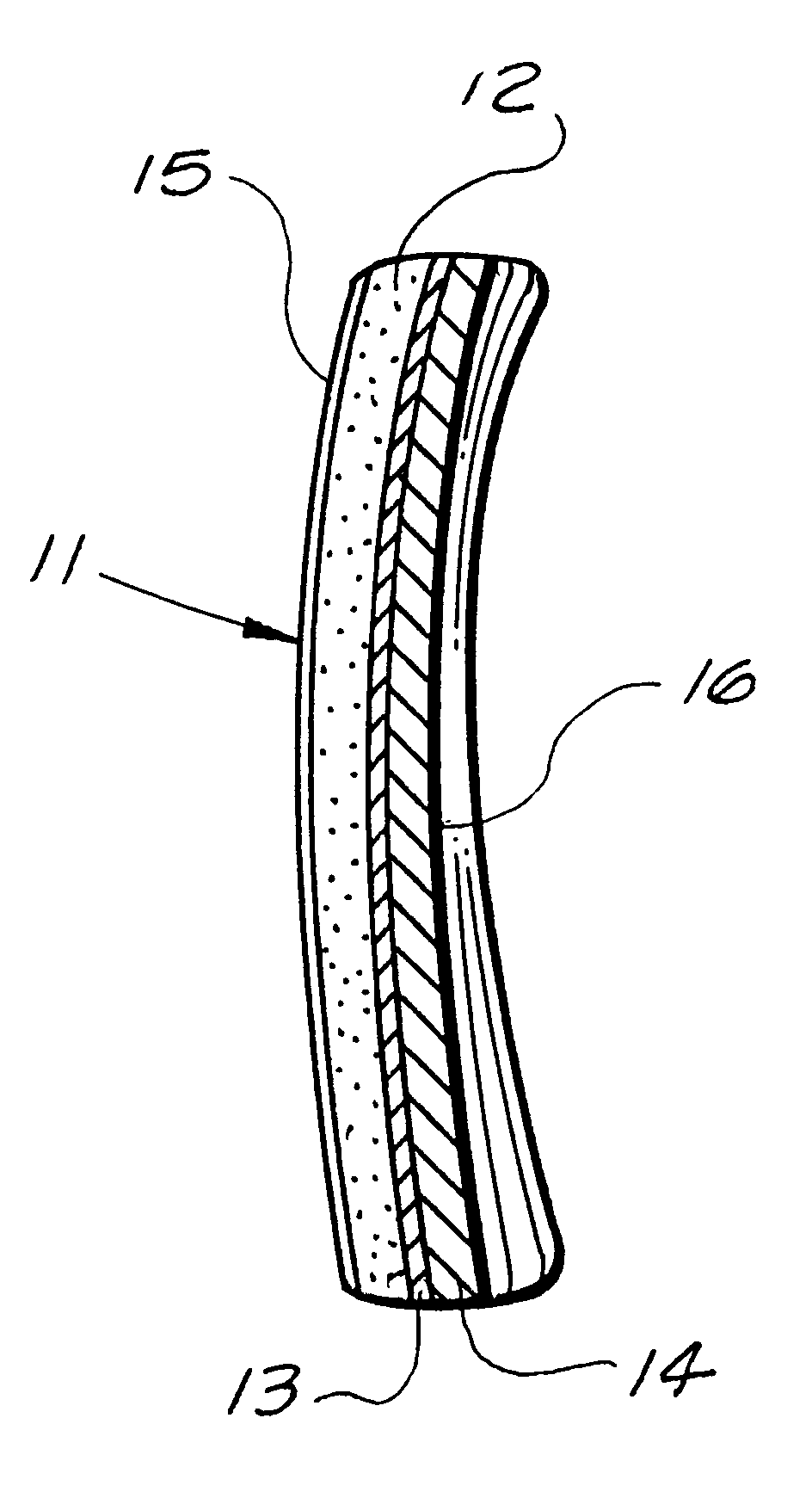 Ceramic armor apparatus for multiple bullet protection