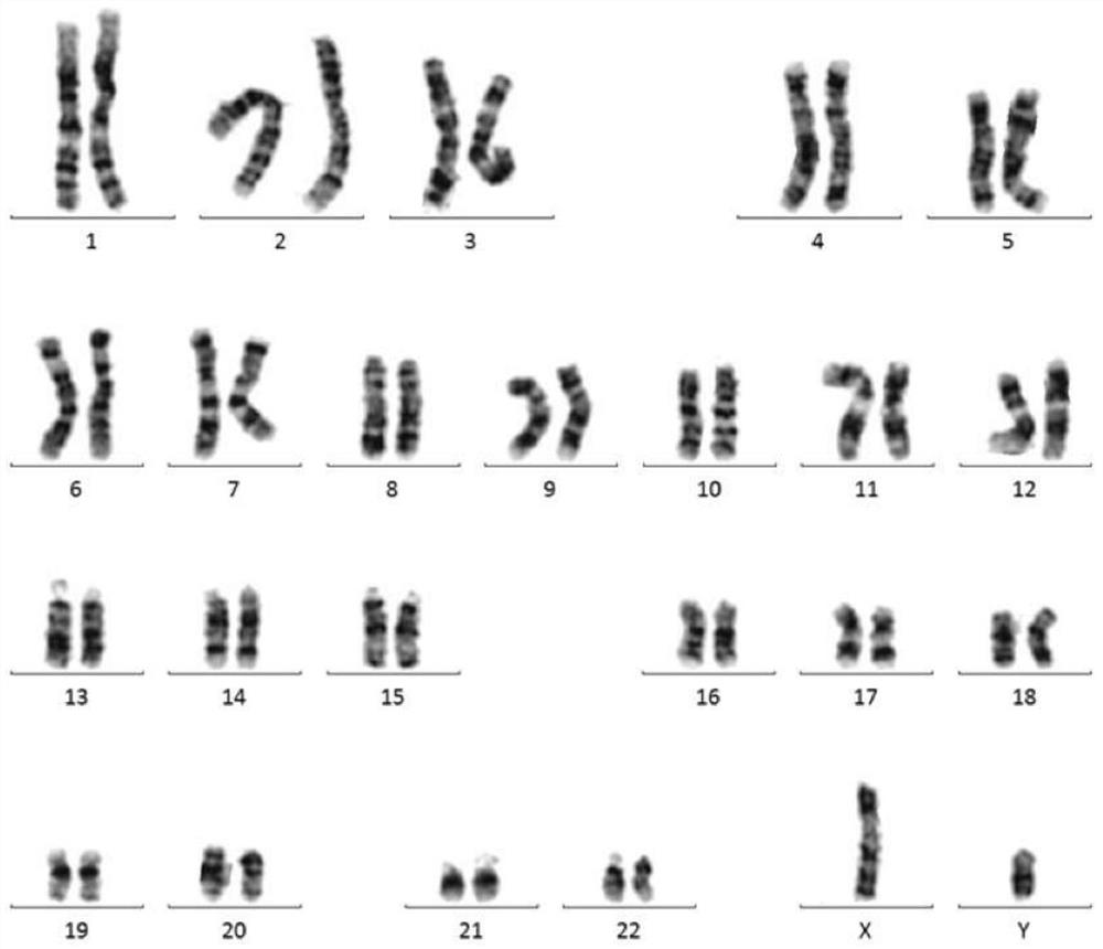 Optimal chromosome karyotype map splicing method, optimal chromosome karyotype map splicing system and chromosome karyotype analysis method