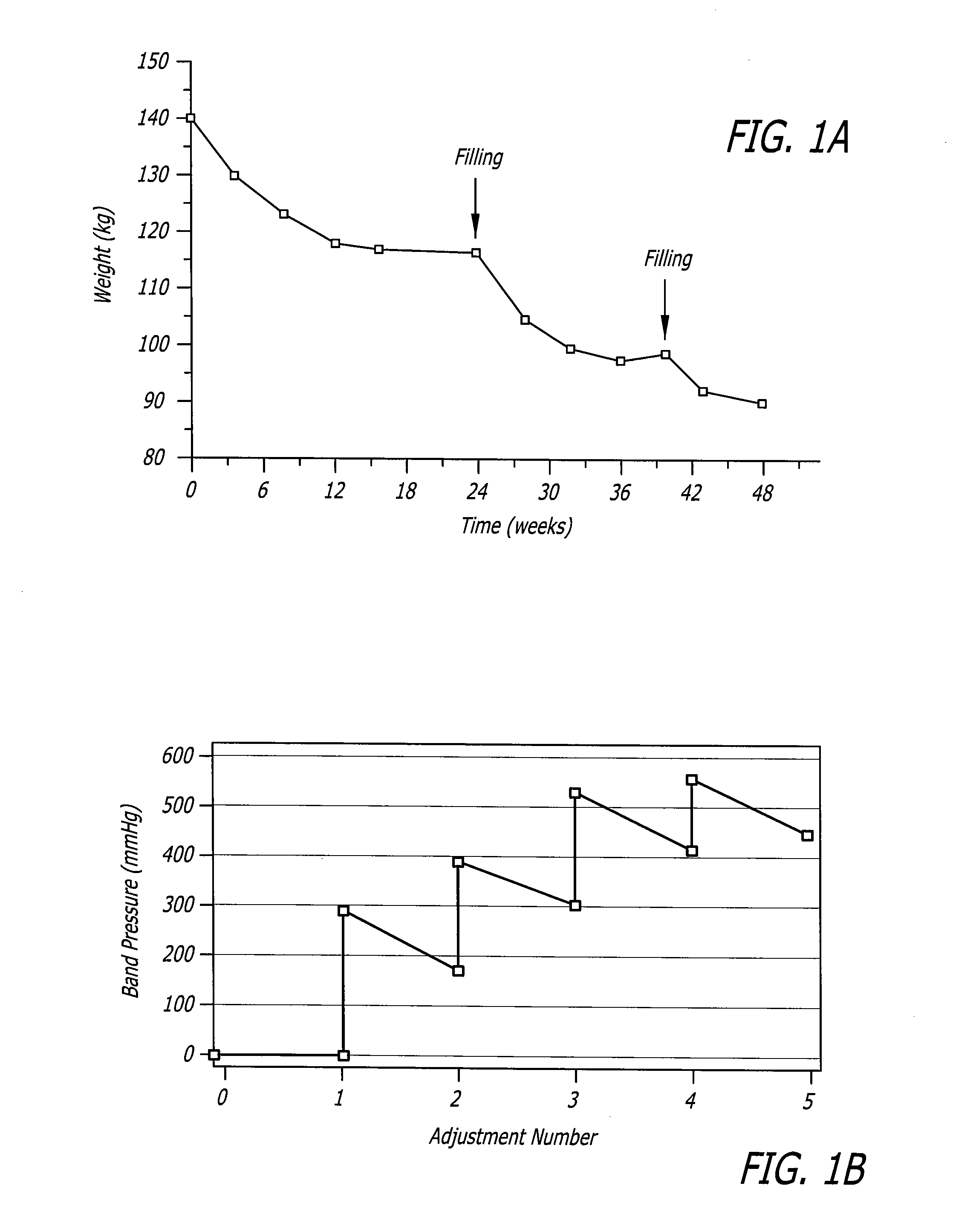 Assembly and method for automatically controlling pressure for a gastric band