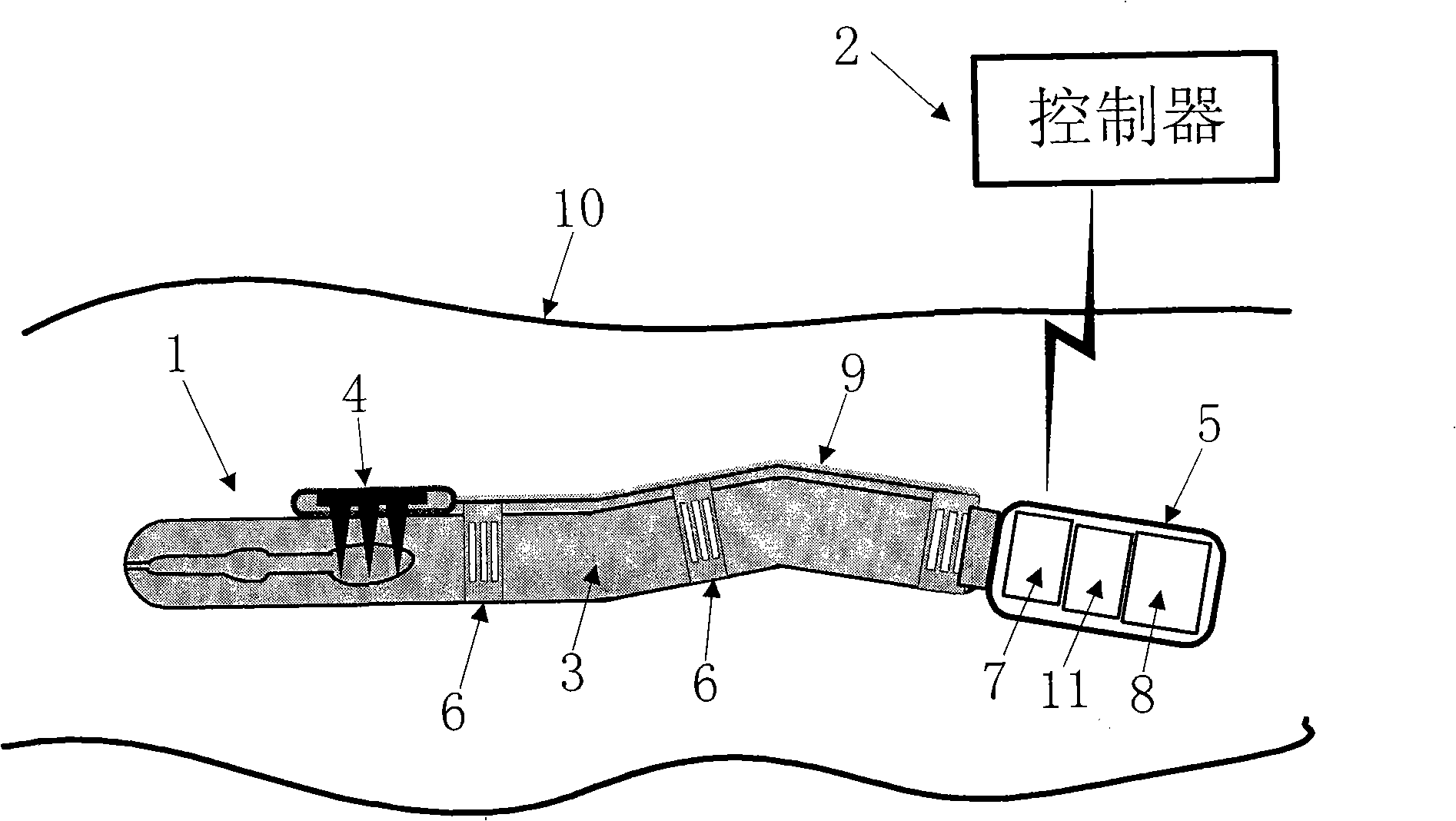 Intestinal tract diagnosing and treating robot system and motion control method thereof