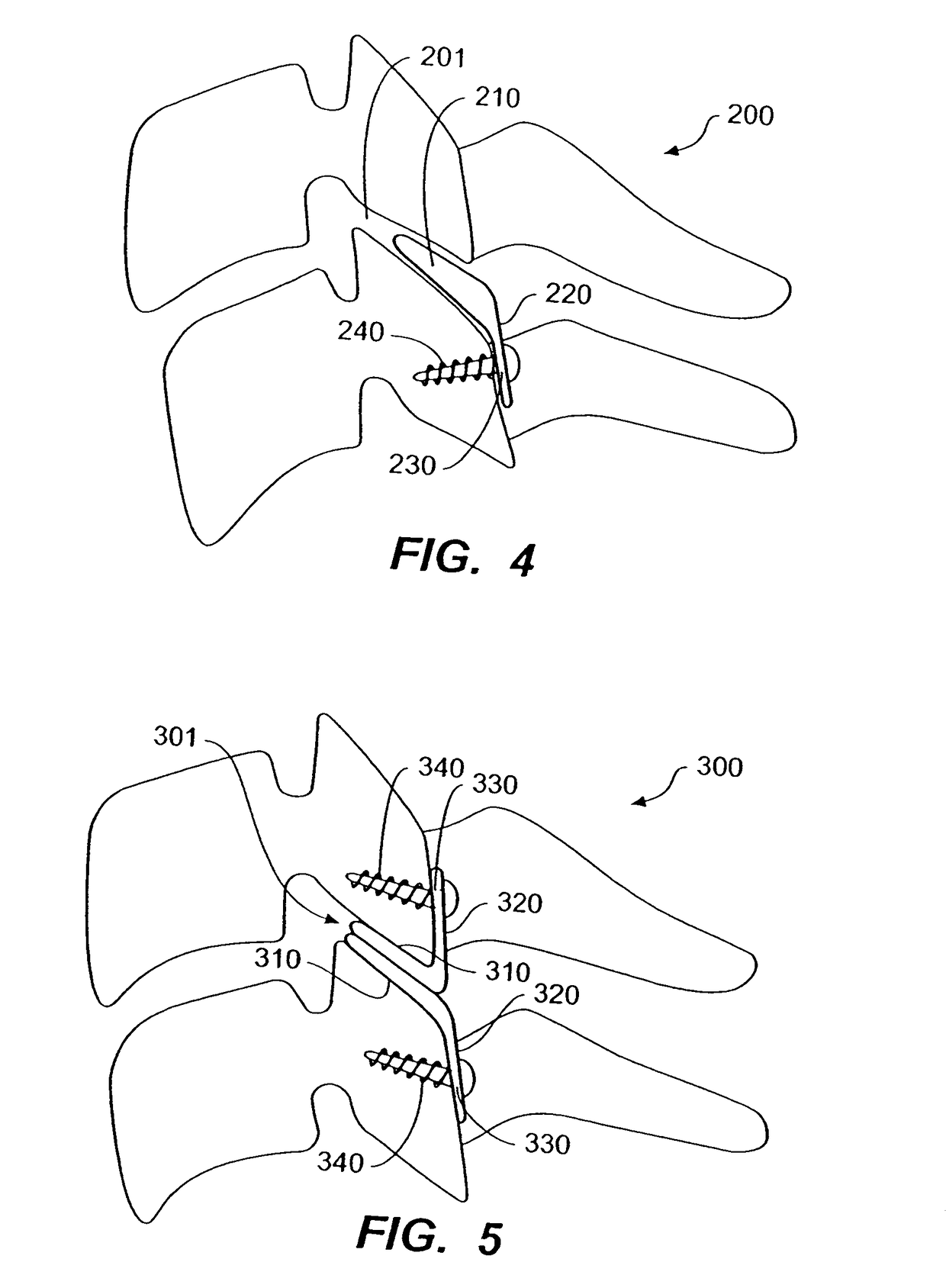 Inter-cervical facet implant with multiple direction articulation joint and method for implanting