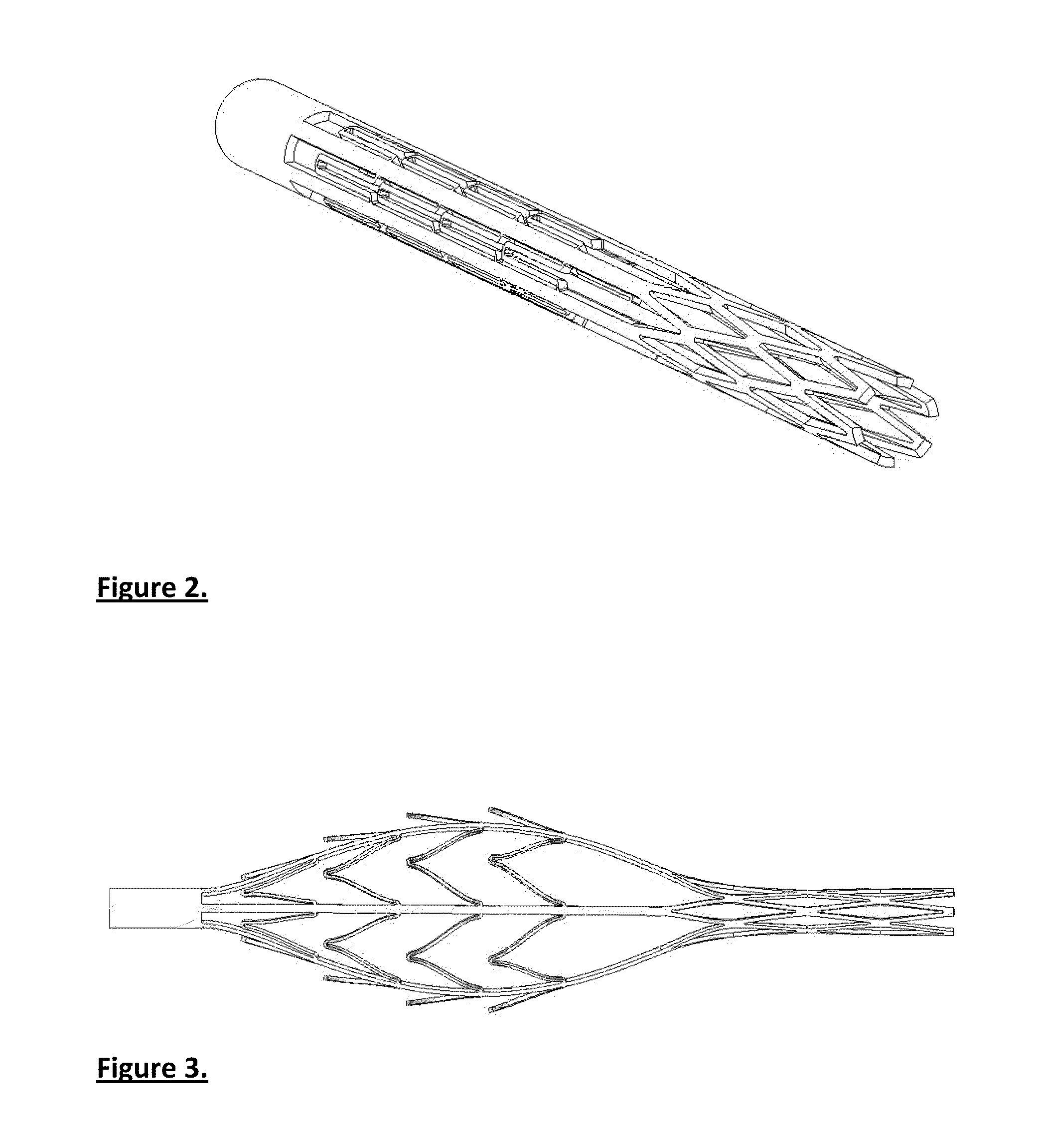 A device suitable for removing matter from inside the lumen and the wall of a body lumen