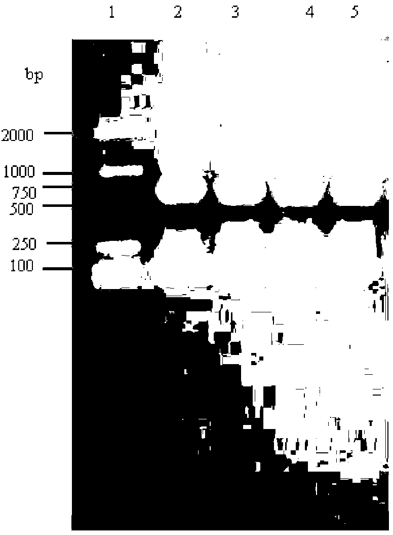 Halogenohydrin dehalogenation enzyme and encoding gene and vector and bacterial strain and application