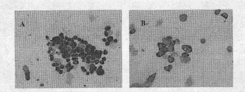 Targeted human CD147 small molecule RNA interference sequence and use thereof