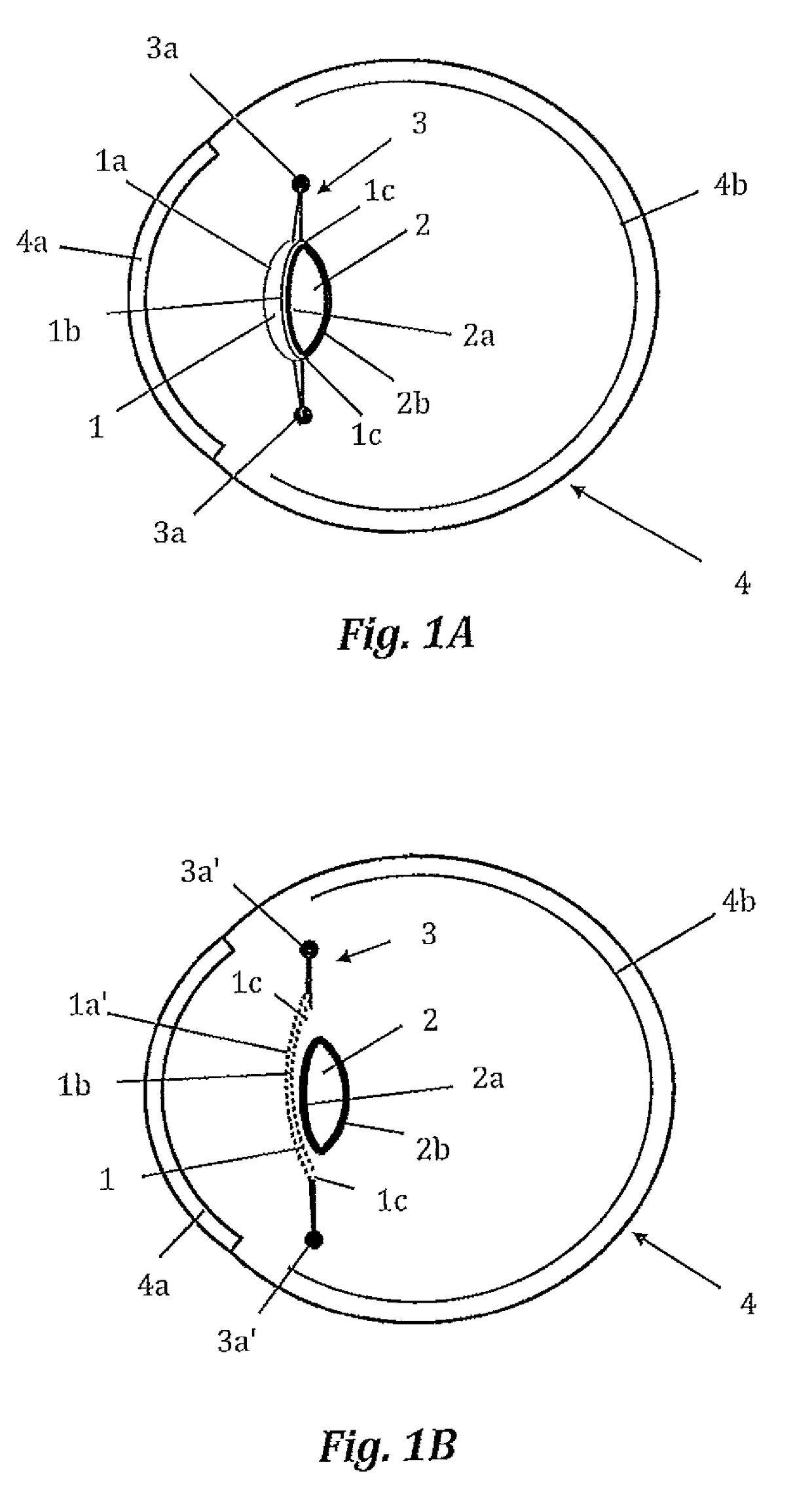 Intraocular lens with accommodation capacity