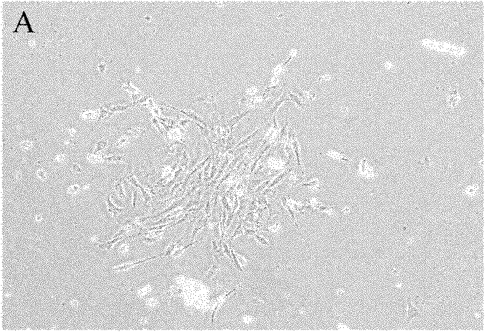 Adipose-derived stem cell separation culture method