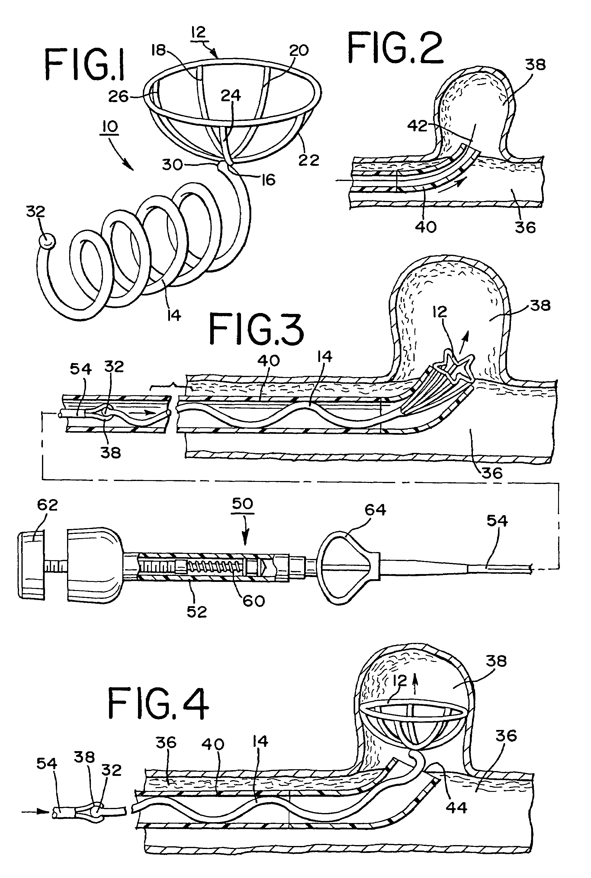 Stent aneurysm embolization device