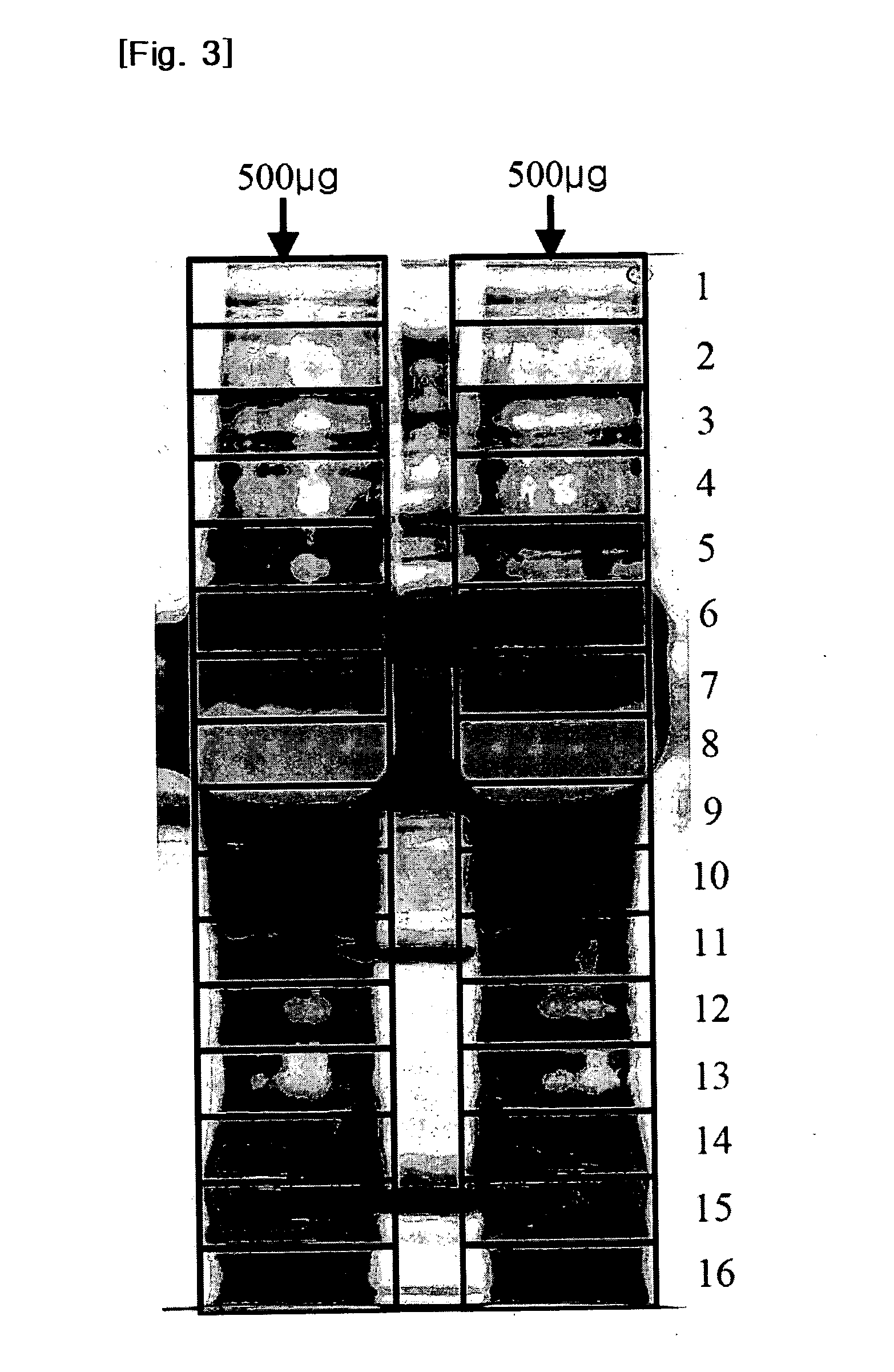 Biomaker composition for detecting diabetic retinopathy and diagnostic kit therefor