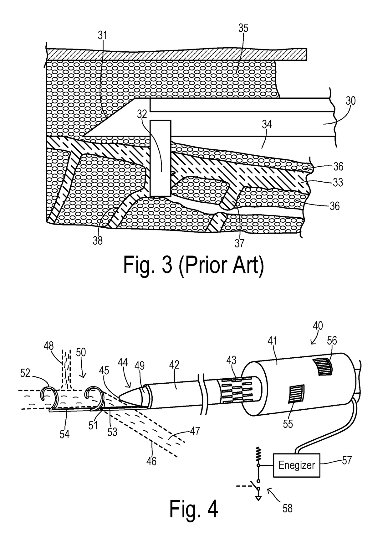 Endoscopic vessel harvester with blunt and active ring dissection