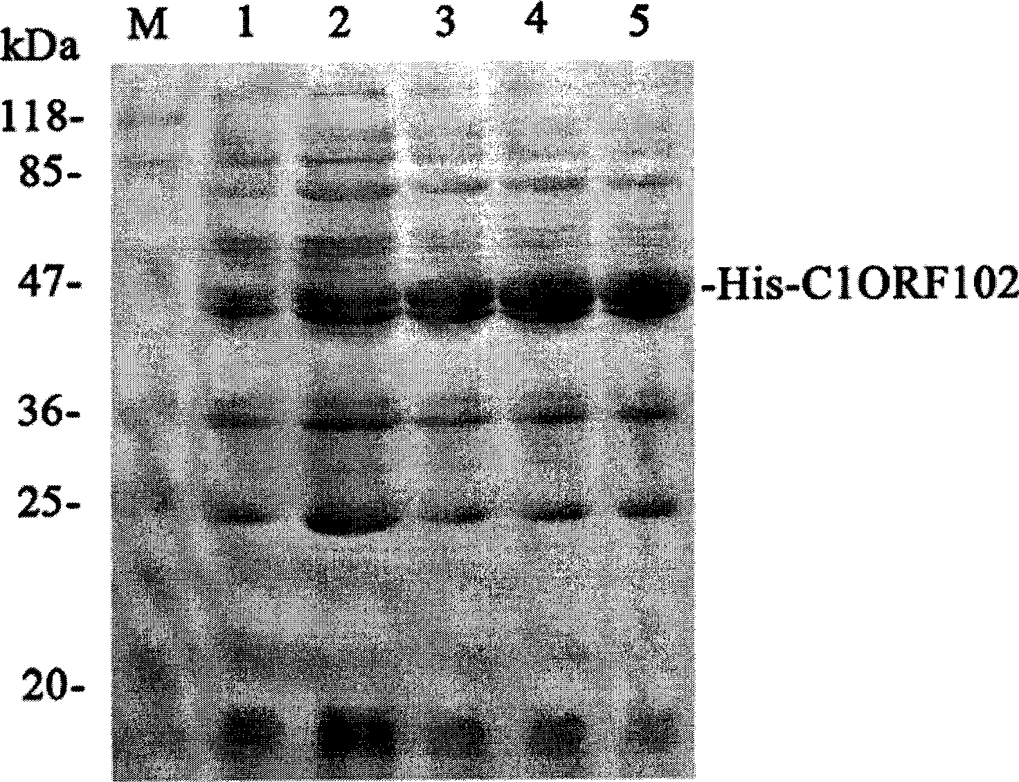 Preparations of human rhinopharynx tissue specific gene C10RF102 coding protein, polyclonal antibody and monoclonal antibody thereof