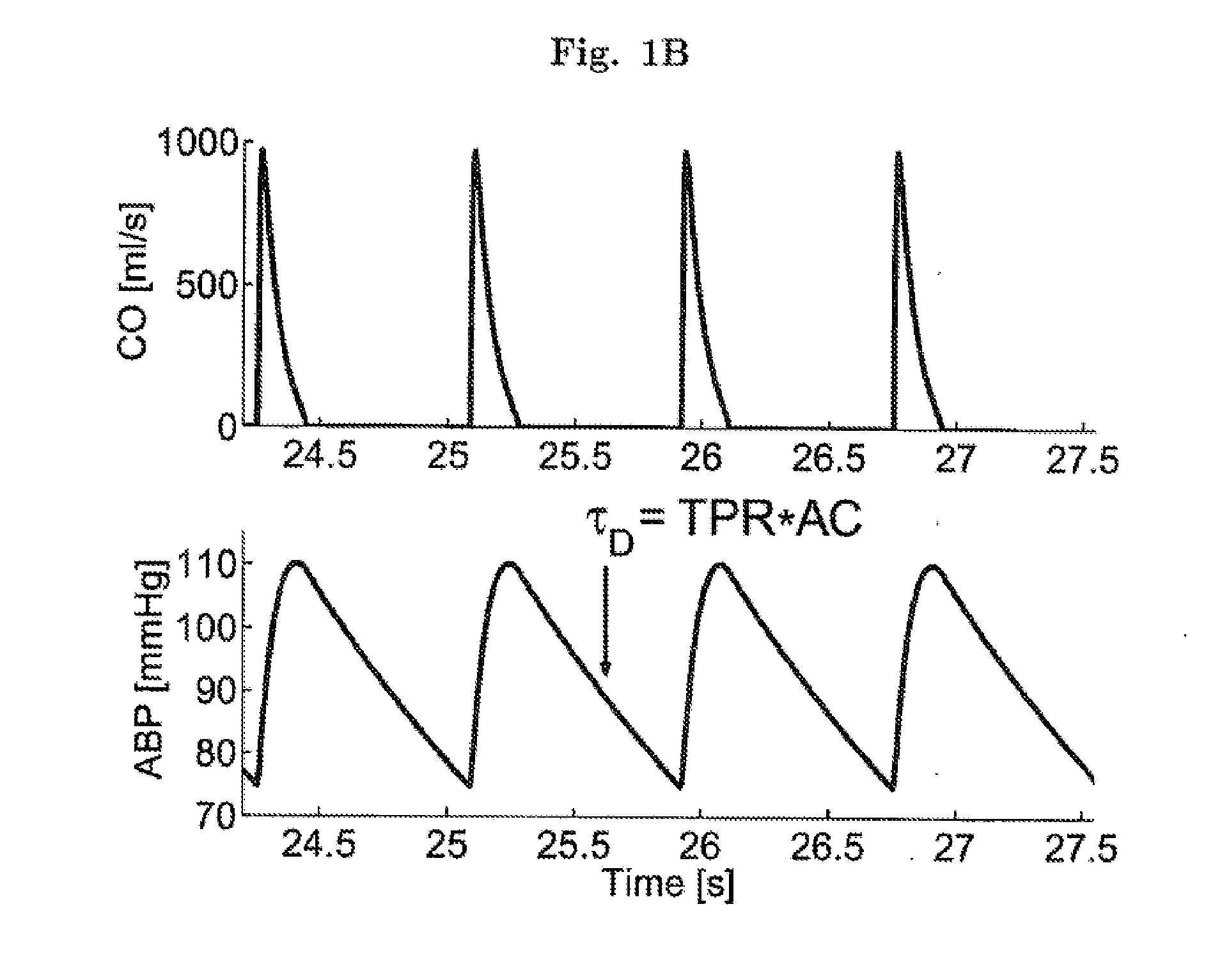 Methods and apparatus for determining cardiac output