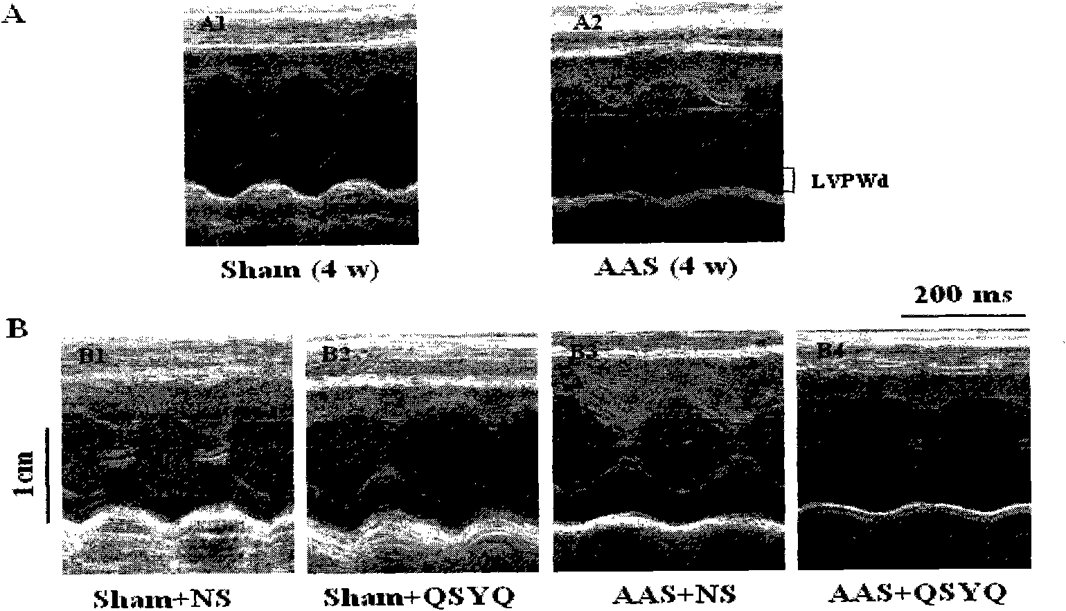 Application of qi-tonifying dripping pill containing radix astragali and root of red-rooted salvia to preparation of medicament for improving myocardial fibrosis and myocardial hypertrophy