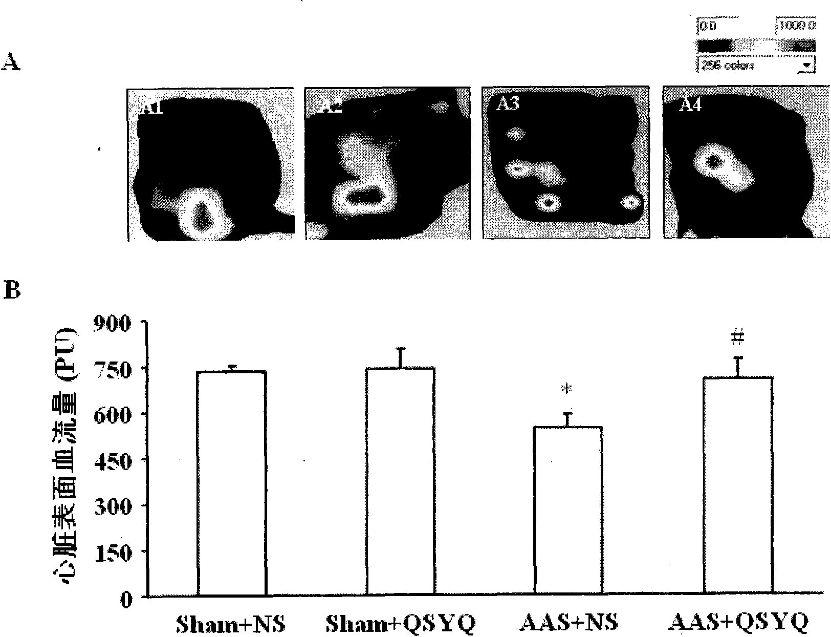 Application of qi-tonifying dripping pill containing radix astragali and root of red-rooted salvia to preparation of medicament for improving myocardial fibrosis and myocardial hypertrophy