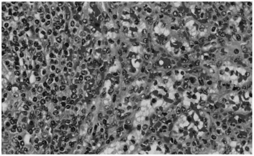 Hematoxylin staining solution oxidation degree monitoring method and a hematoxylin staining solution quality control method