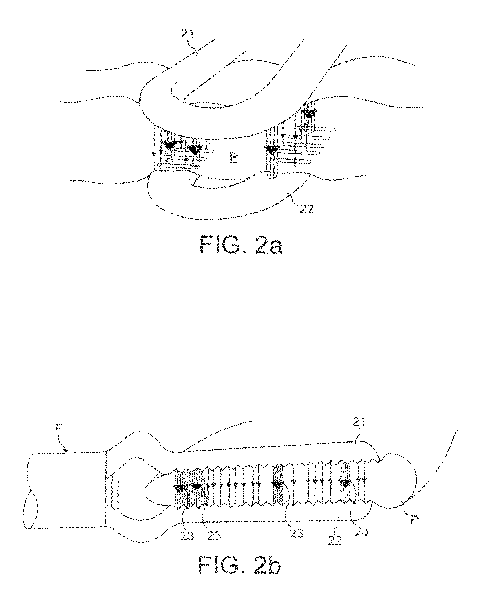 Electrosurgical generator