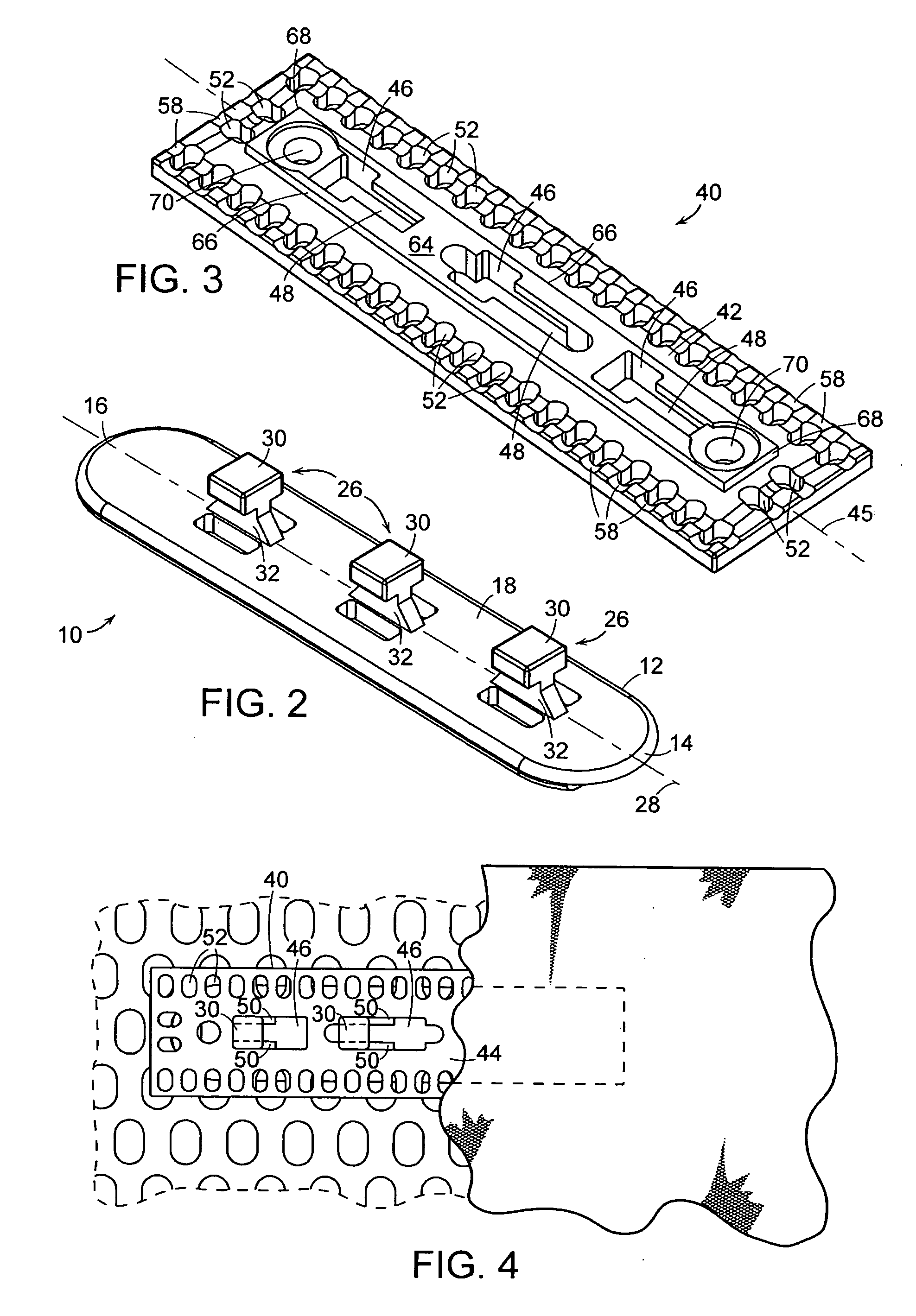 Modular attachment assembly