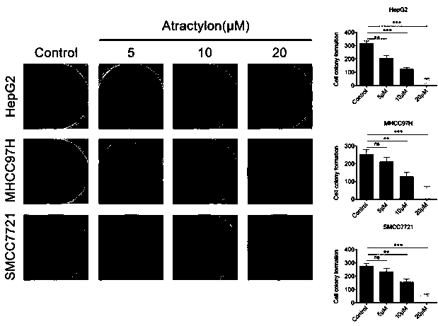 Application of atractylon to preparation of anti-liver cancer molecular target medicine