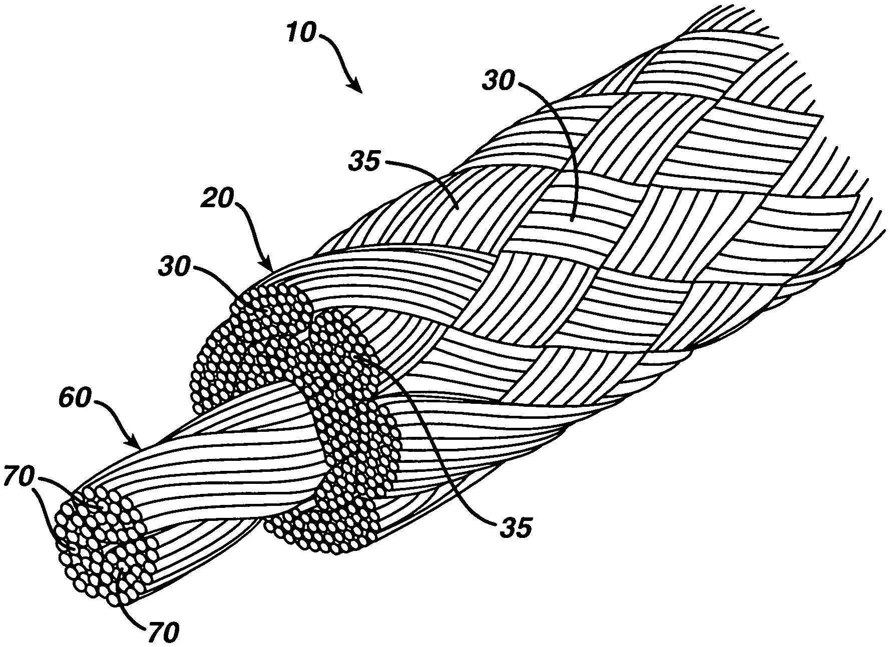 High strength suture with absorbable core and suture anchor combination