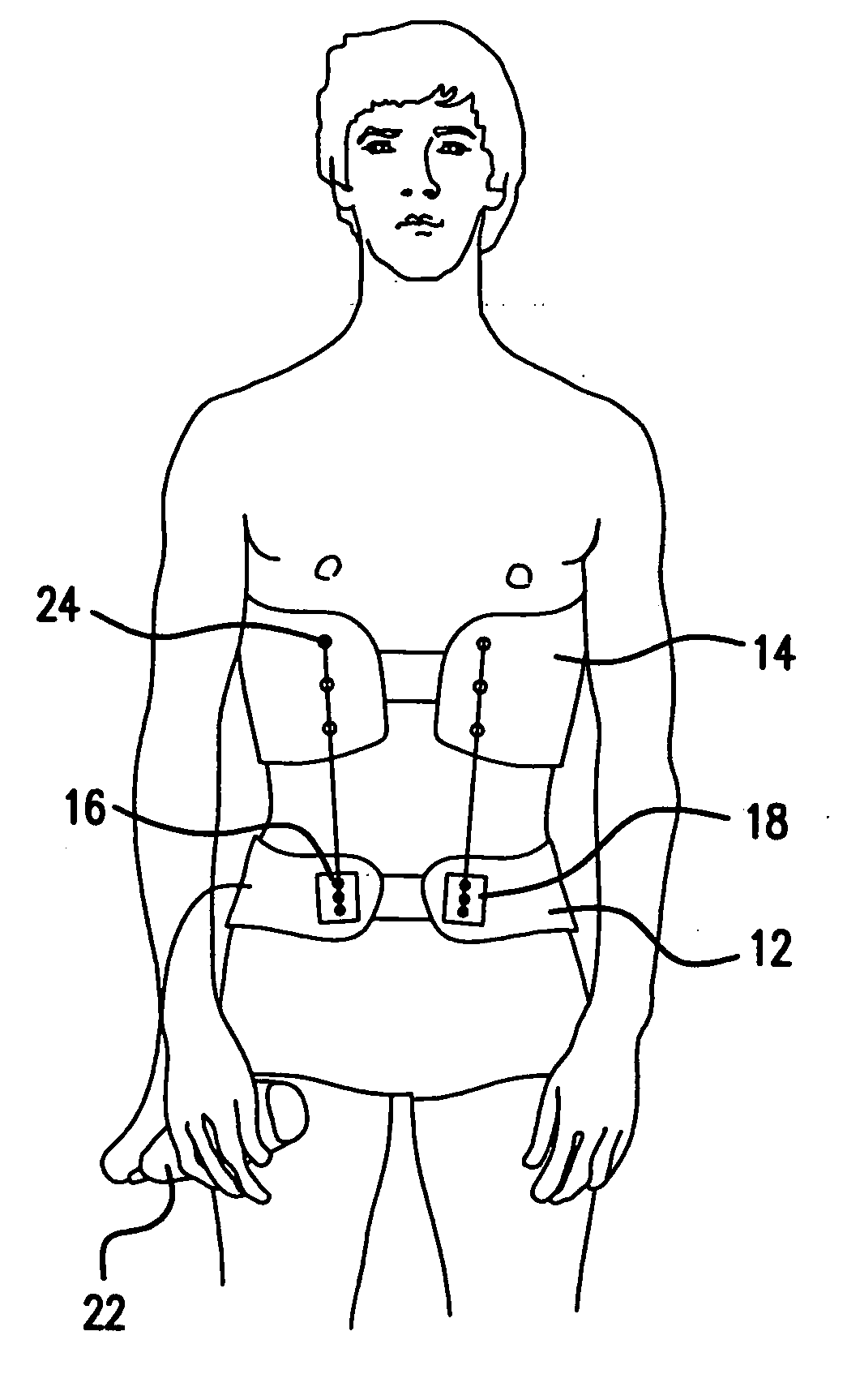 Intermittent passive traction device and method of use