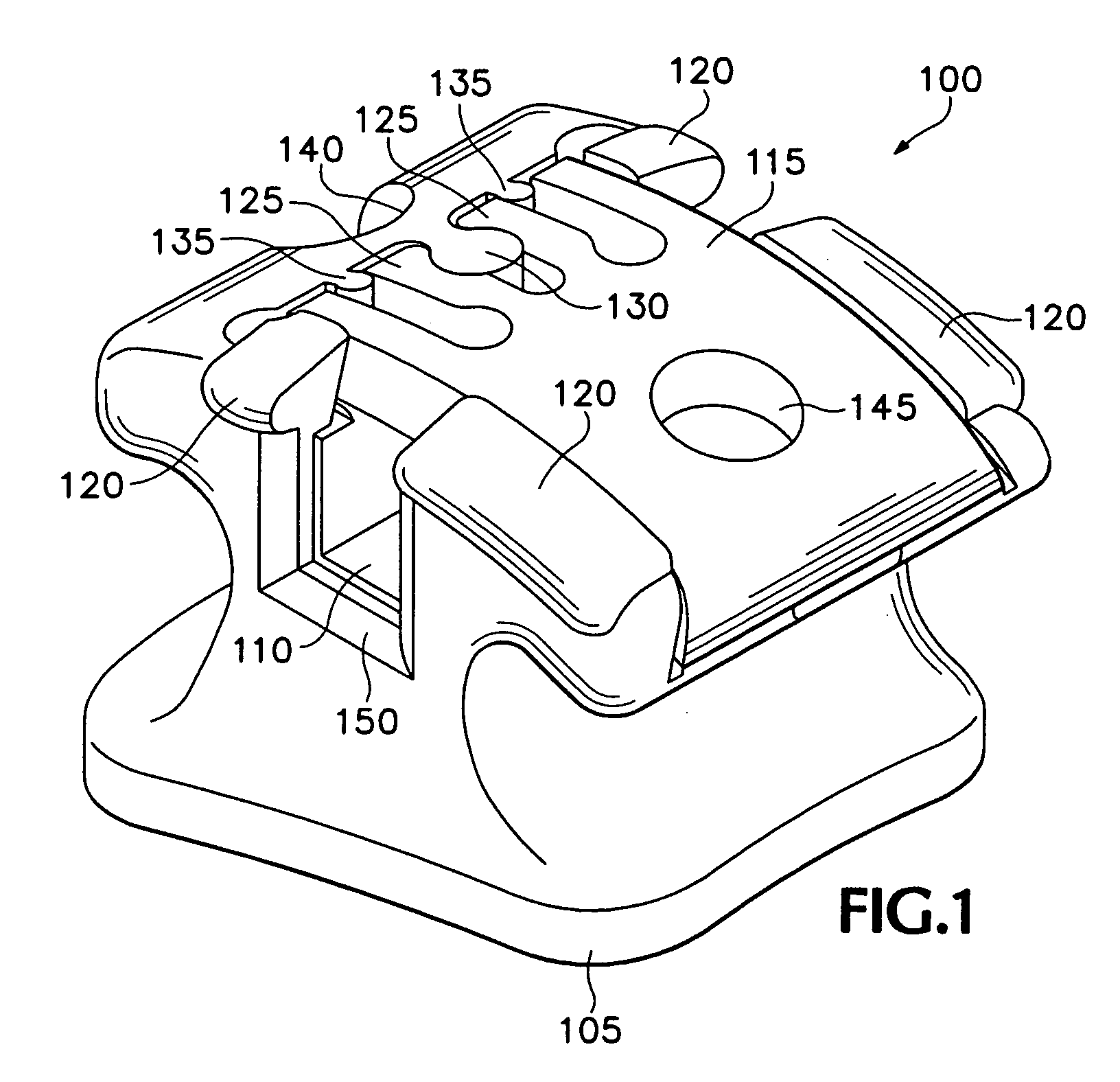 Orthodontic bracket