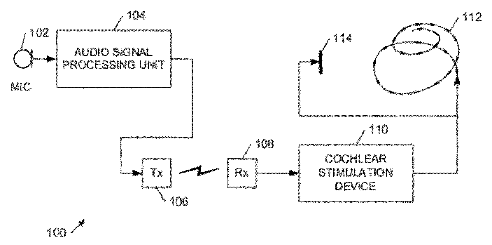 Cochlear implant apparatus and methods