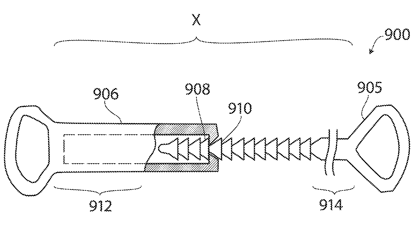 Systems and methods for treatment of sleep apnea