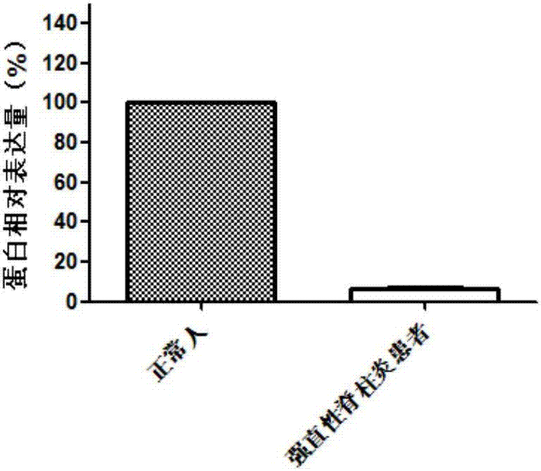 Application of KLHL22 gene and expression product thereof to preparation of diagnostic product