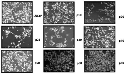 CYTOR and application of inhibitor thereof to resistance to castration resistant tumor