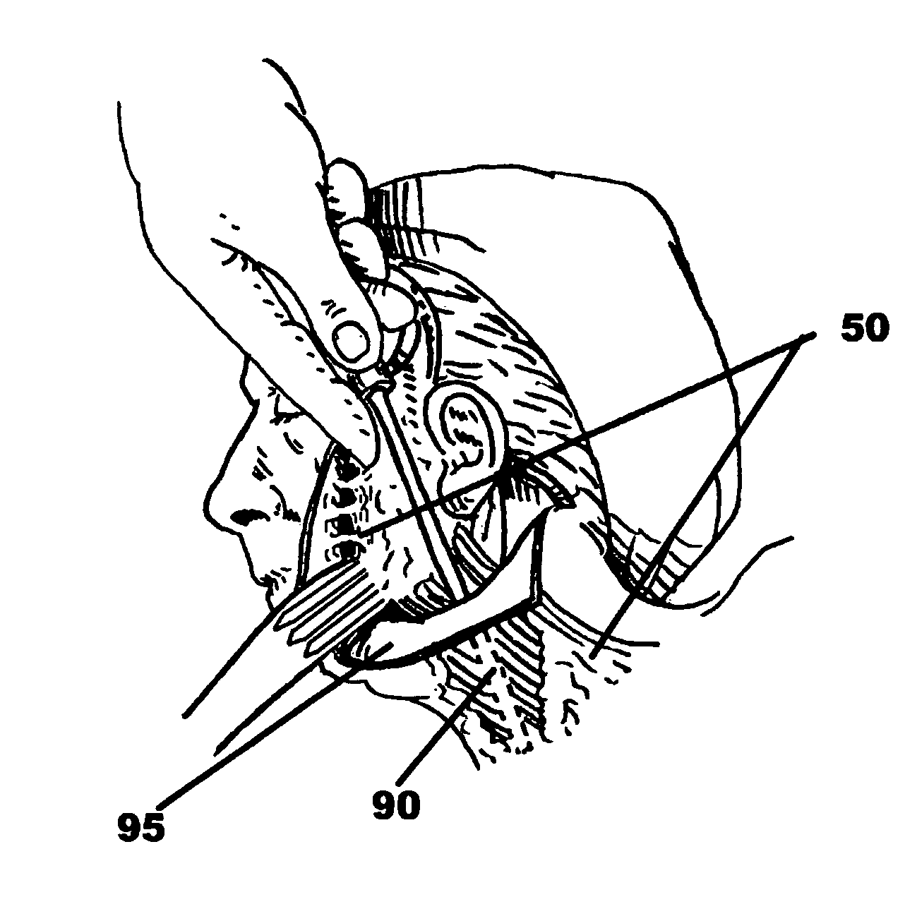 Facial tissue strengthening and tightening device and methods