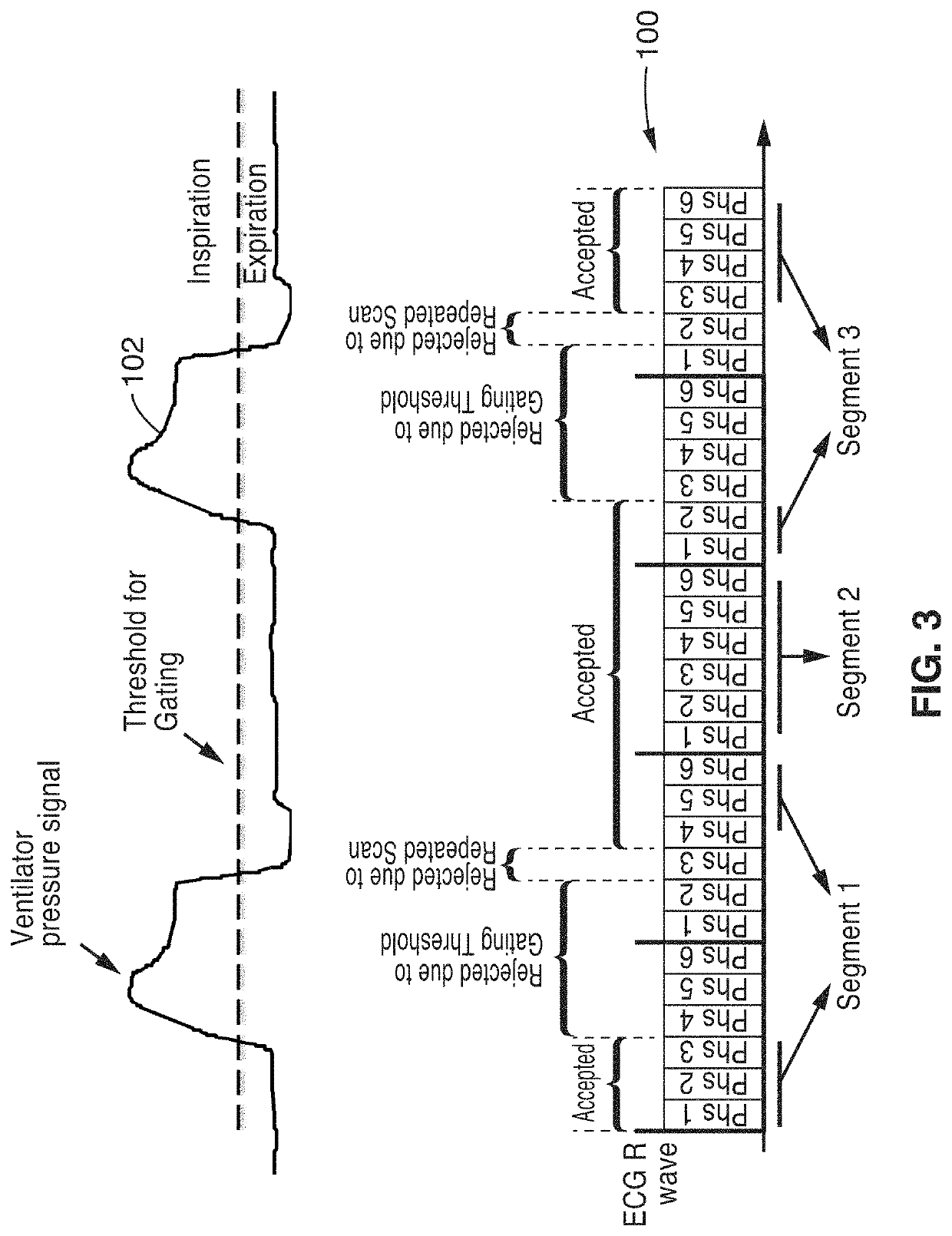 Cardiac phase-resolved non-breath-hold 3-dimensional magnetic resonance angiography