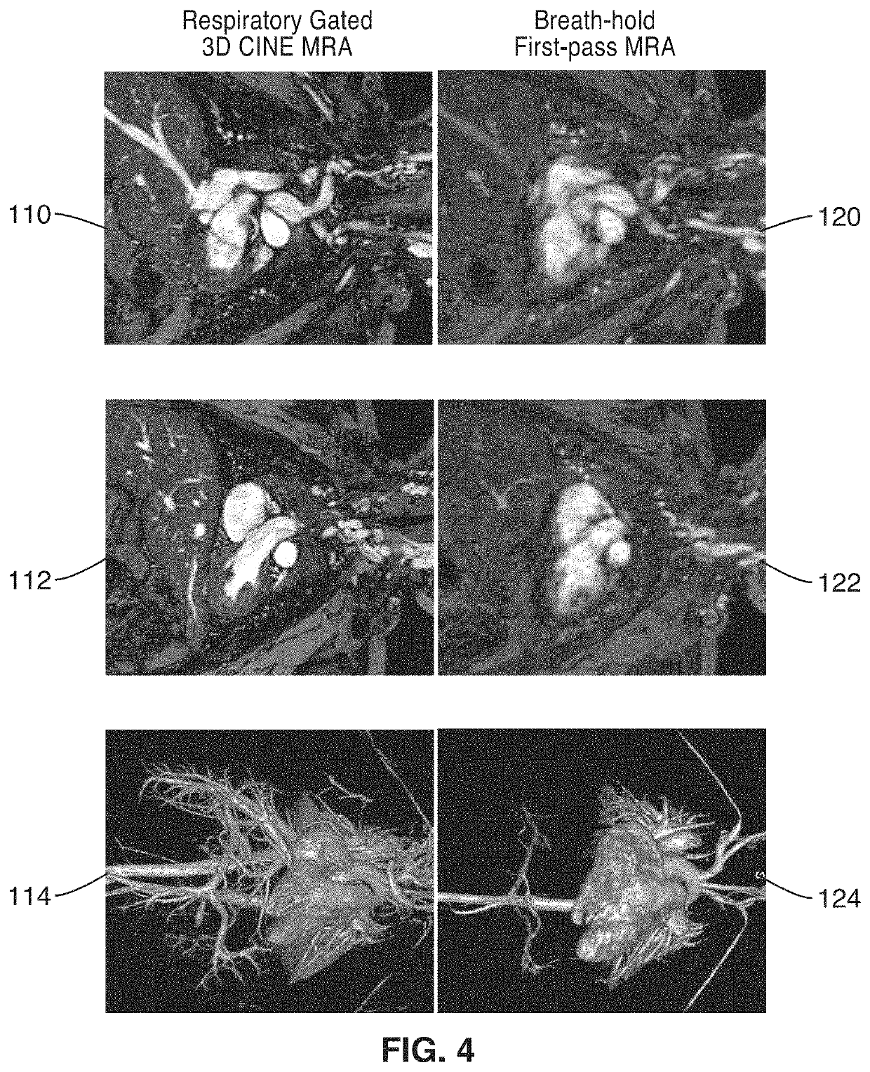 Cardiac phase-resolved non-breath-hold 3-dimensional magnetic resonance angiography