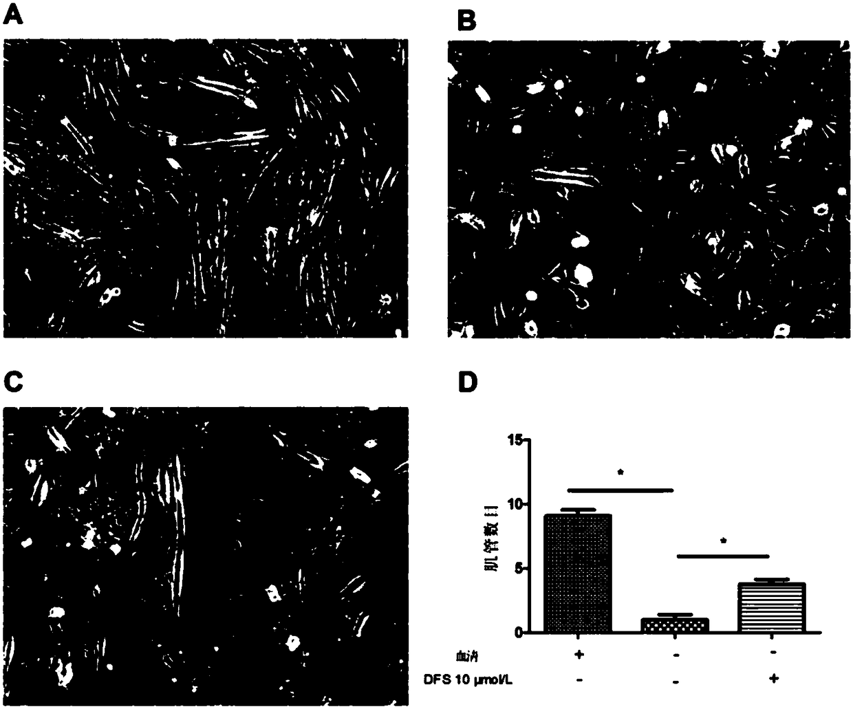 Application of deferasirox to preparation of drug for treating sarcopenia disease