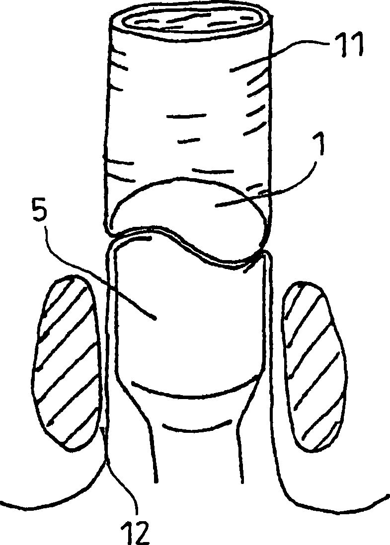 A surgical stapling instrument and a staple cartridge and staple for such an instrument