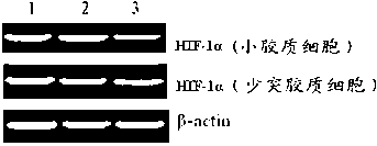 Targeting polypeptide-gene composite as well as preparation method and application of composite