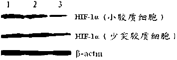 Targeting polypeptide-gene composite as well as preparation method and application of composite