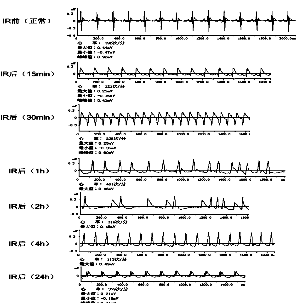 Chinese herbal medicine composition for relieving arrhythmia, and preparation method and application thereof