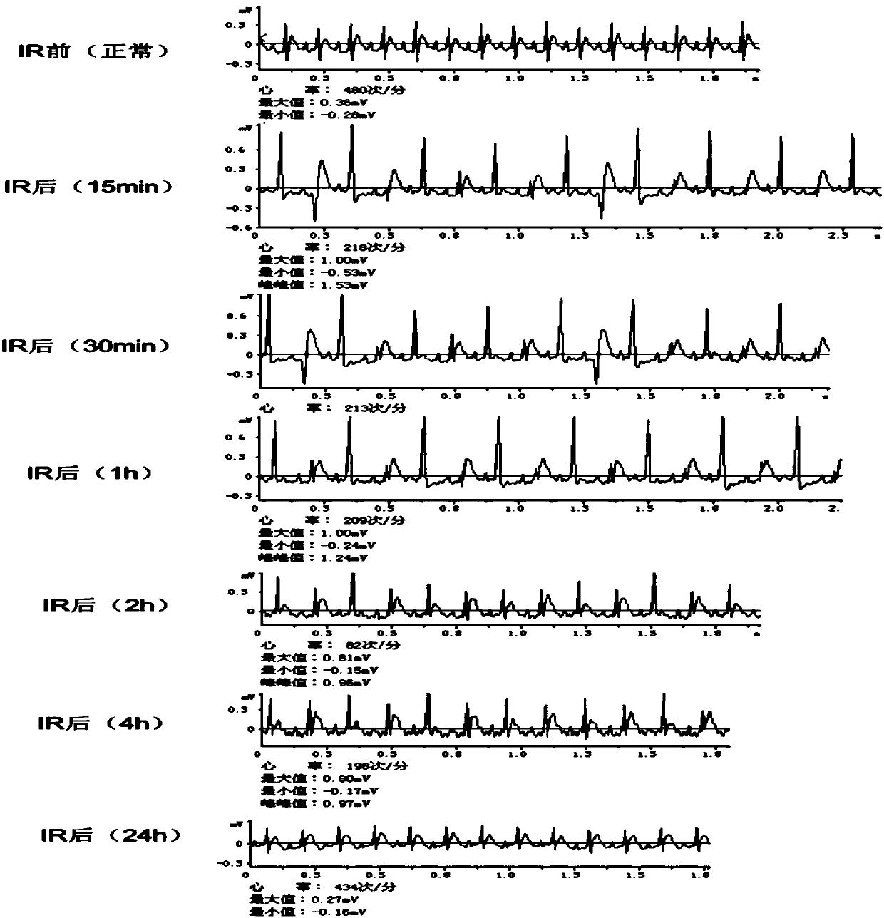 Chinese herbal medicine composition for relieving arrhythmia, and preparation method and application thereof