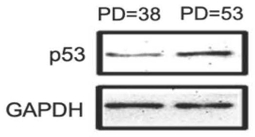 Application of hemo as a marker of aging