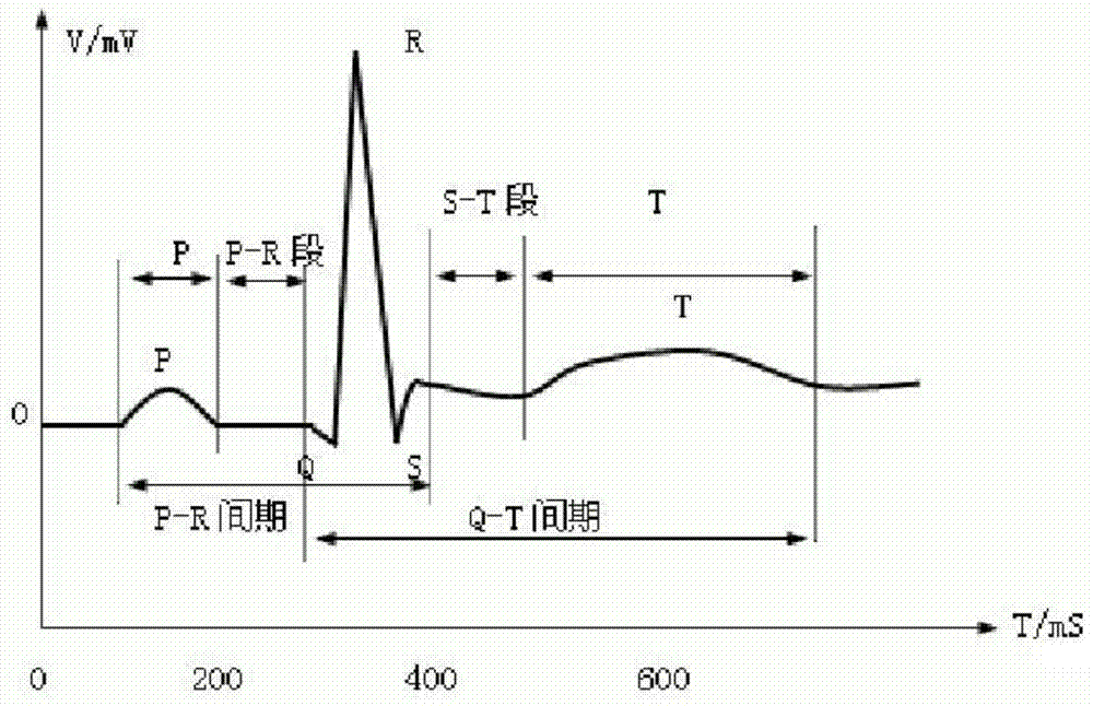 A Fatigue Driving Detection Method Fusion of ECG Signal and Steering Wheel Pressure