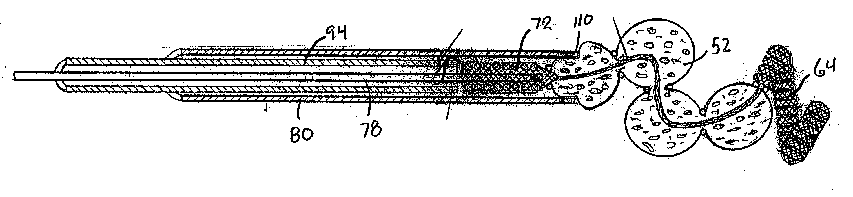 Aneurysm treatment devices and methods