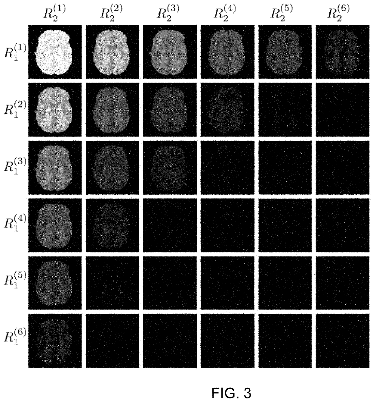 Joint estimation diffusion imaging (JEDI)