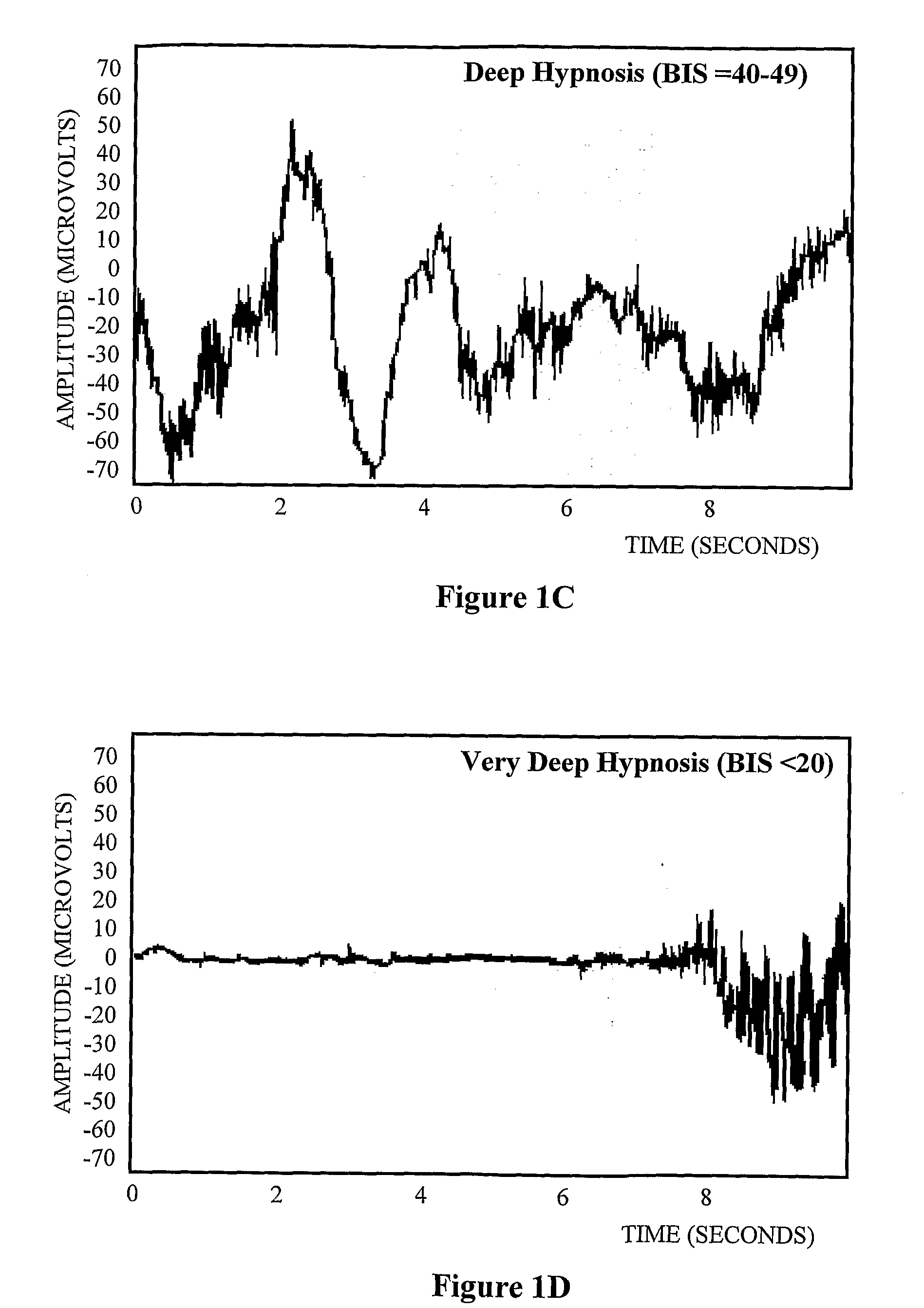 Sonification of Level of Consciousness of a Patient