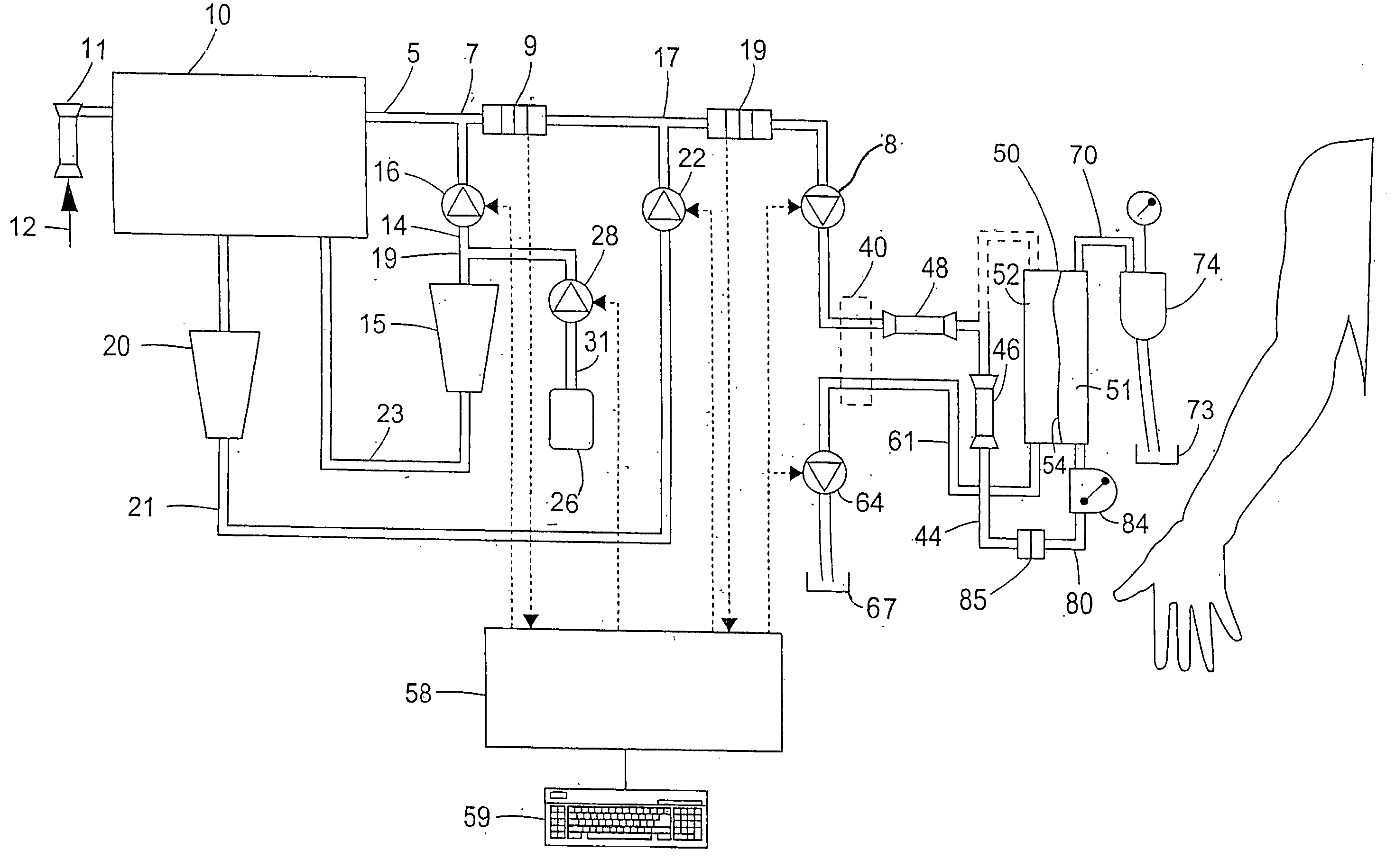 Method of operating a dialysis machine