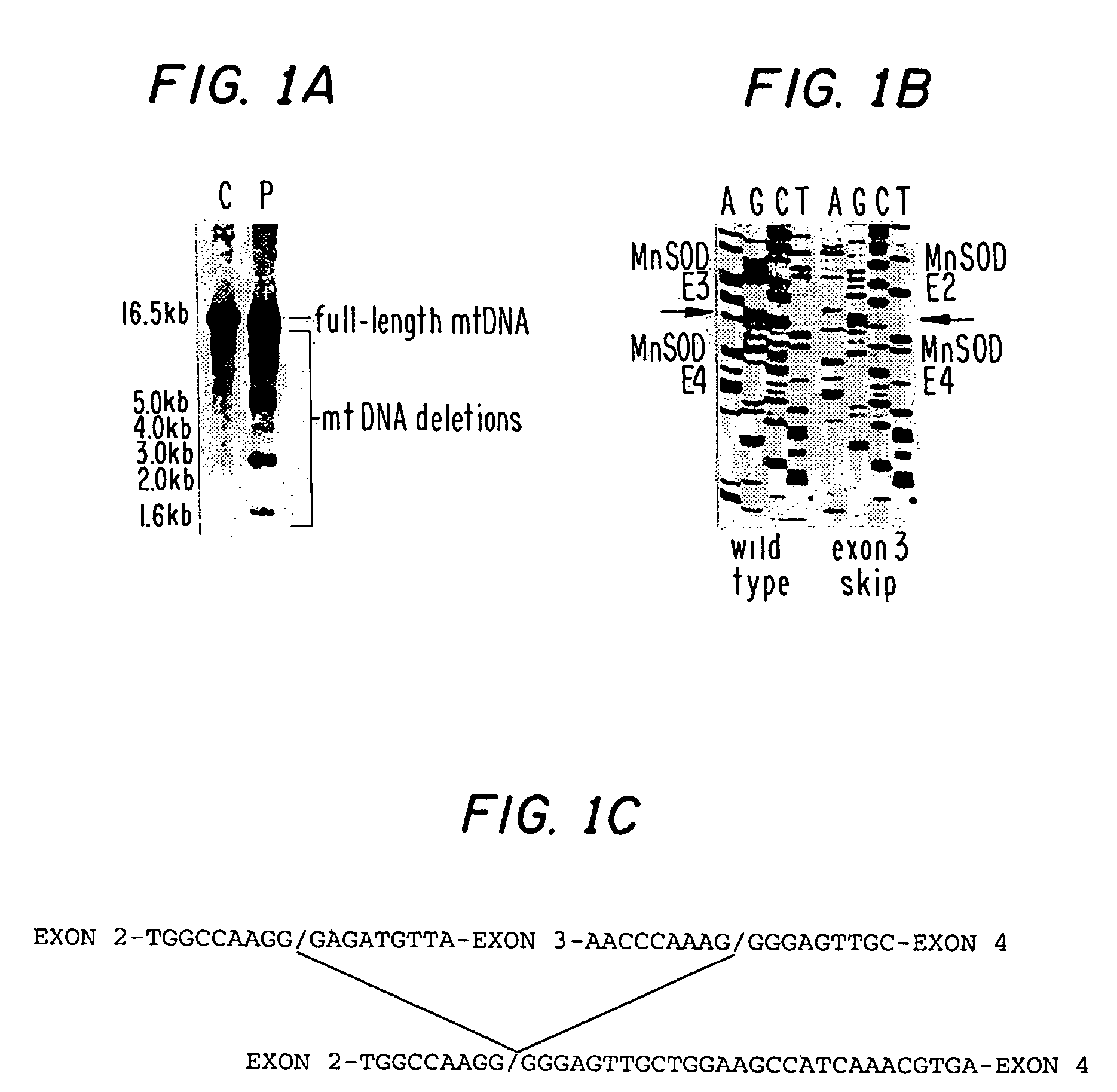 Manganese superoxide dismutase exon 3-deleted isoforms and nucleic acid molecules encoding the isoforms