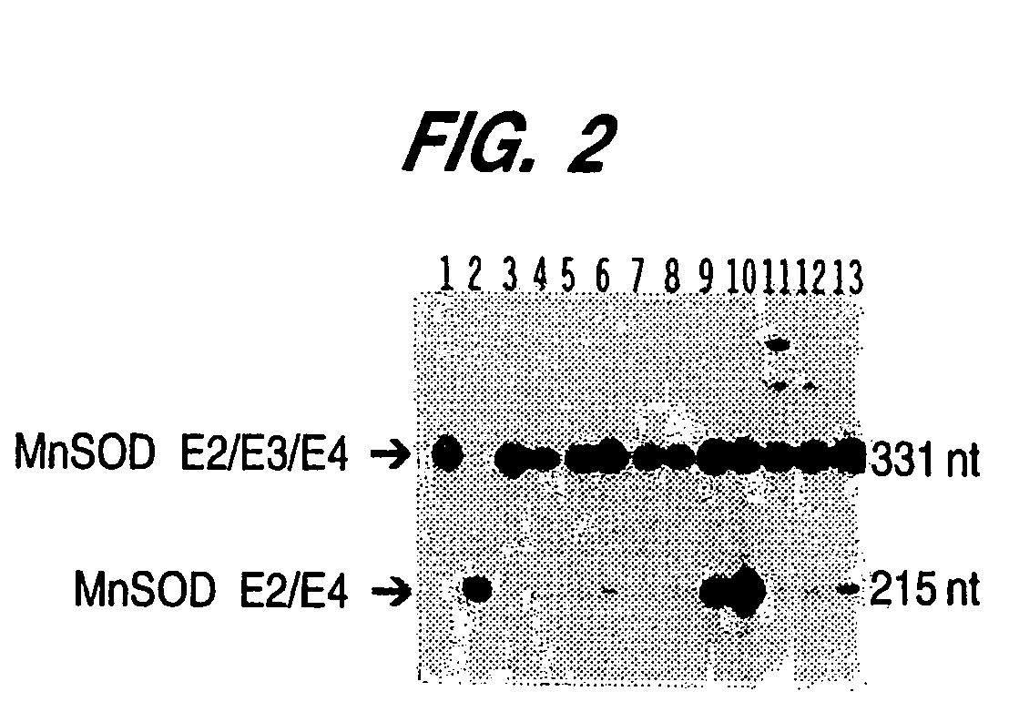 Manganese superoxide dismutase exon 3-deleted isoforms and nucleic acid molecules encoding the isoforms