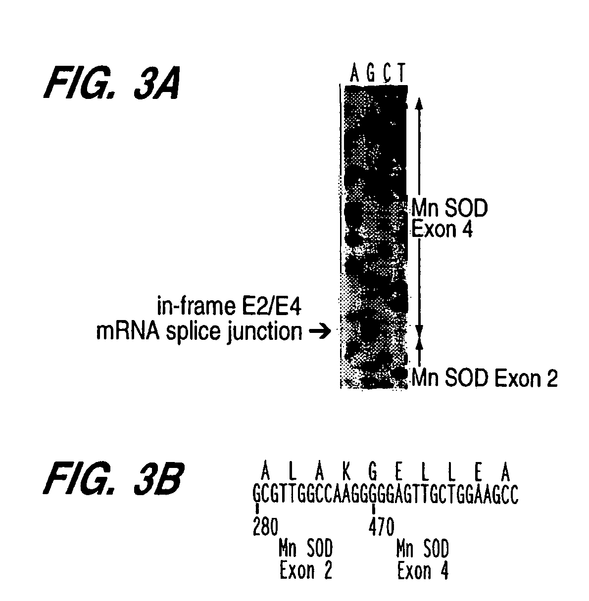 Manganese superoxide dismutase exon 3-deleted isoforms and nucleic acid molecules encoding the isoforms