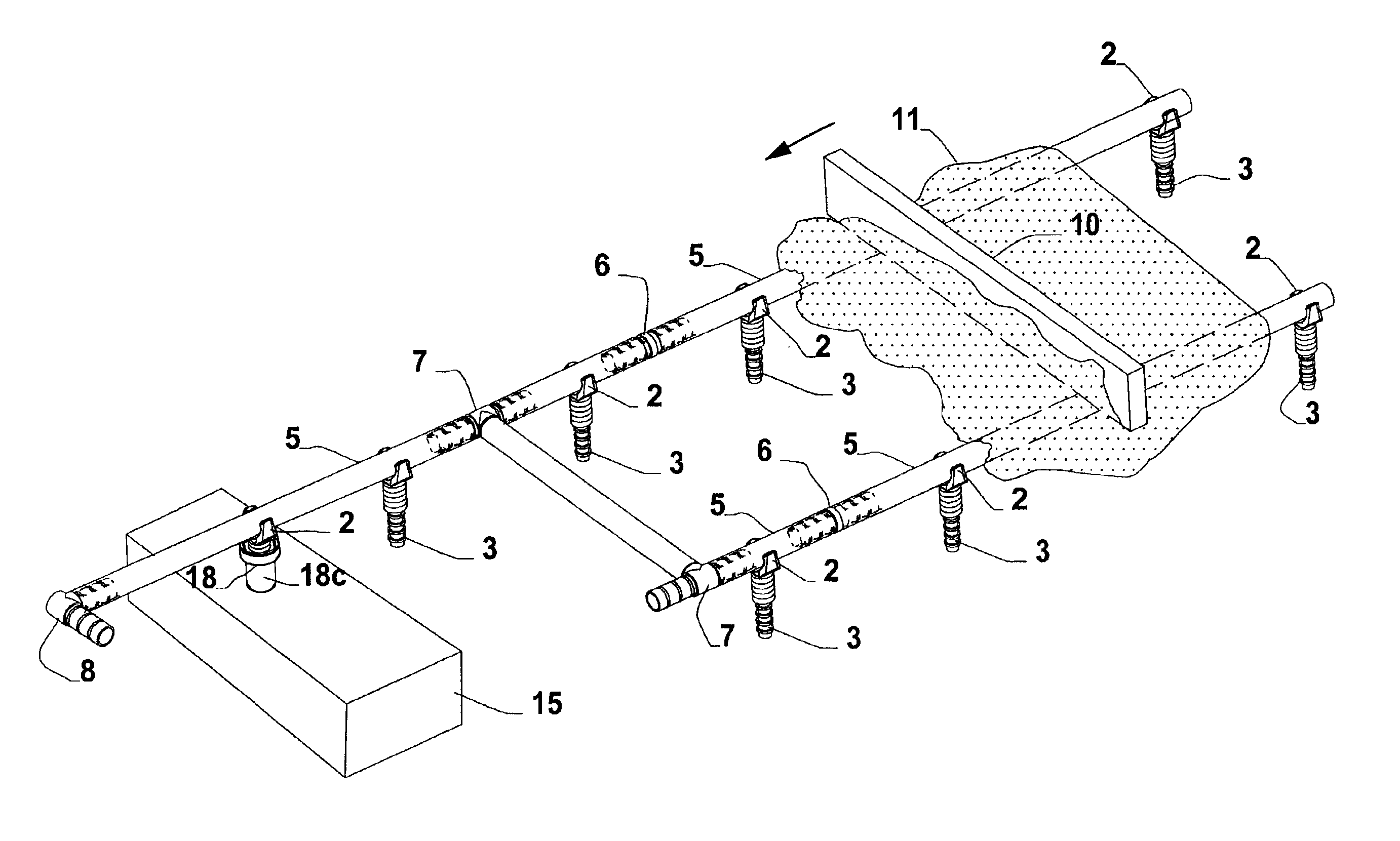 Screed ski and support system and method