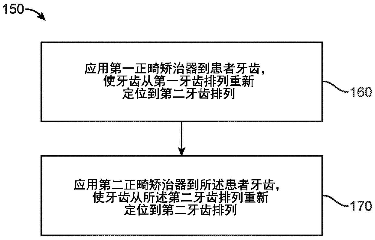 Systems, methods, and apparatus for correcting malocclusions of teeth