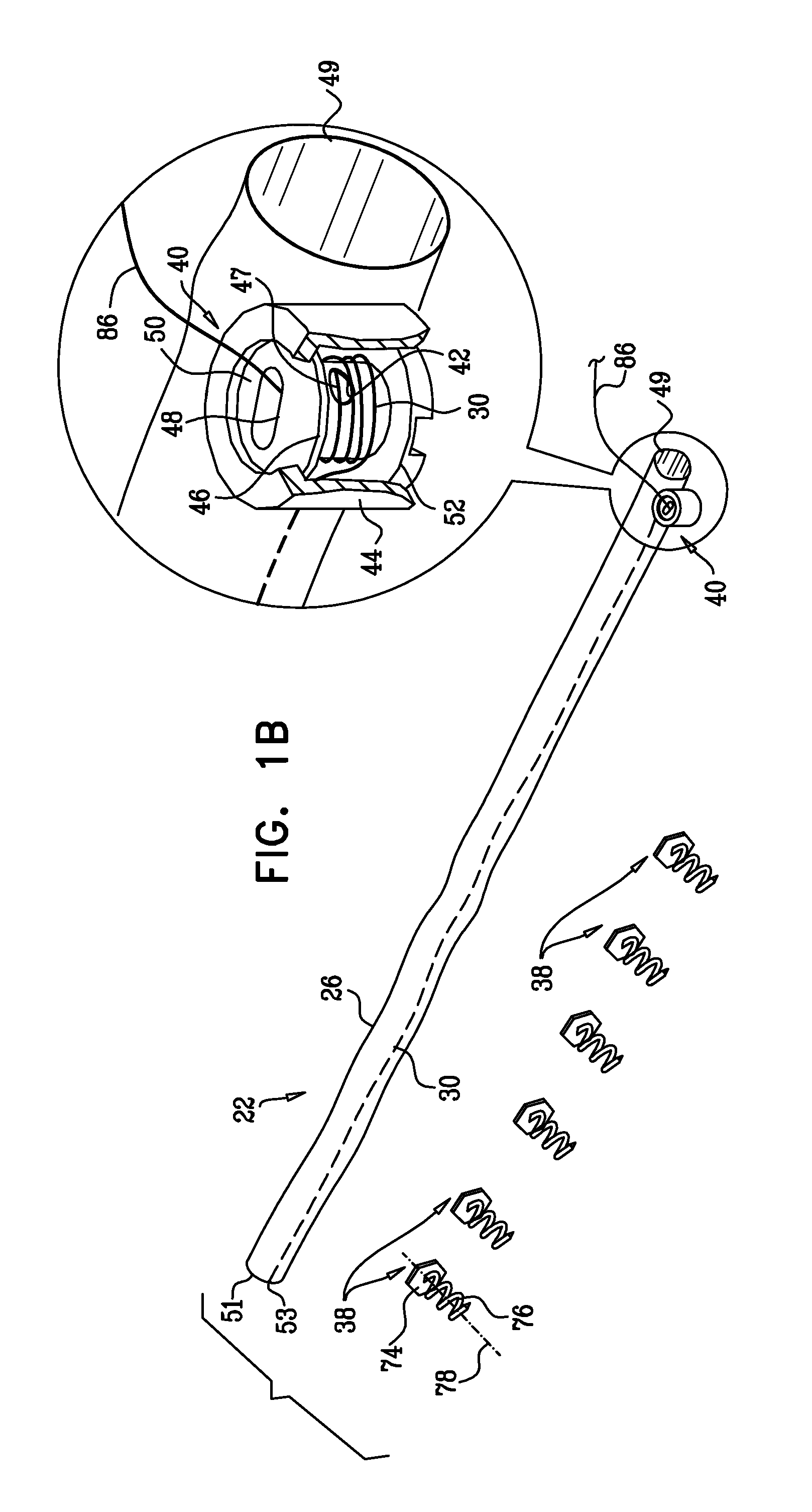 Deployment techniques for annuloplasty ring